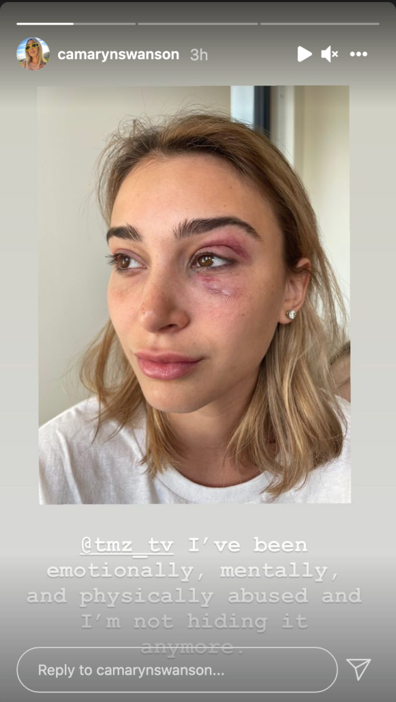 tyga accusato